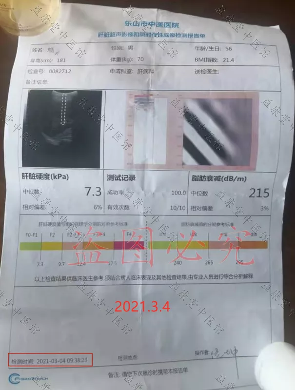 刘强2021.3.4肝硬度.jpg